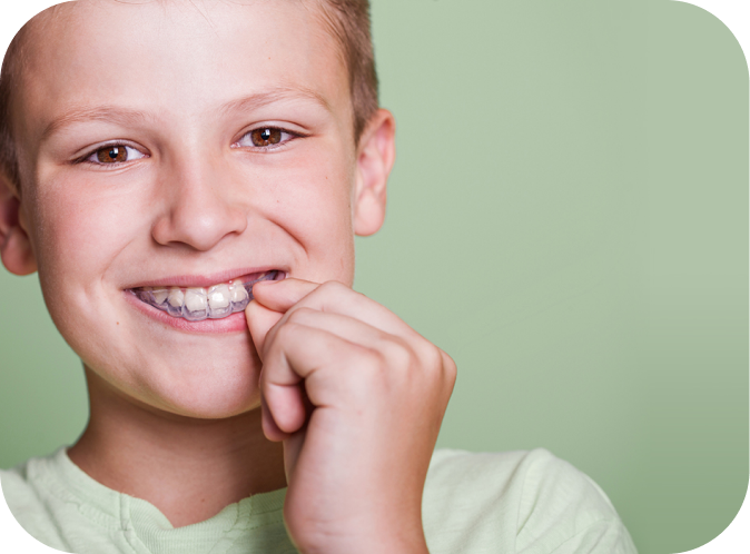 Aligneurs transparents Orthodontiste Marseille 10 | Drs Couchat, Gaillard & Toga