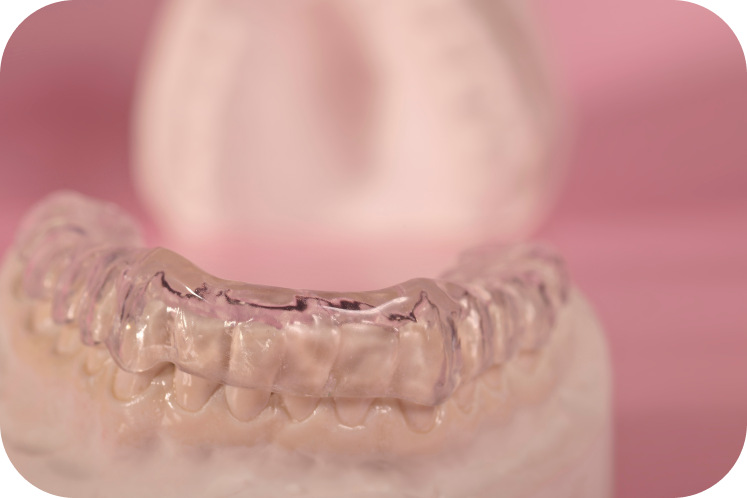 Bruxisme Orthodontiste Marseille 10 | Drs Couchat, Gaillard & Toga