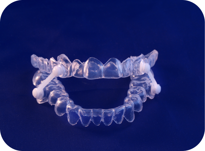 Apnée du sommeil Orthodontiste Marseille 10 | Drs Couchat, Gaillard & Toga