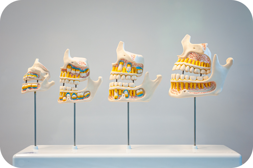 Dents incluses Orthodontiste Marseille 10 | Drs Couchat, Gaillard & Toga