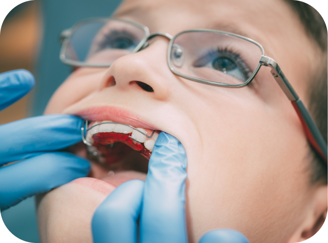 Modalités de prise en charge des soins Orthodontiste Marseille 10 | Drs Couchat, Gaillard & Toga