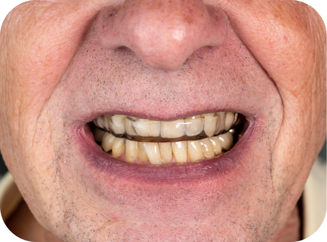 Vieillissement et orthodontie Orthodontiste Marseille 10 | Drs Couchat, Gaillard & Toga