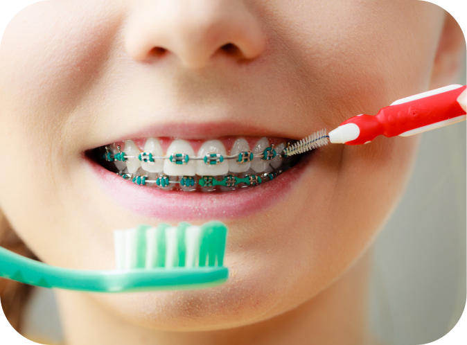 Vieillissement et orthodontie Orthodontiste Marseille 10 | Drs Couchat, Gaillard & Toga