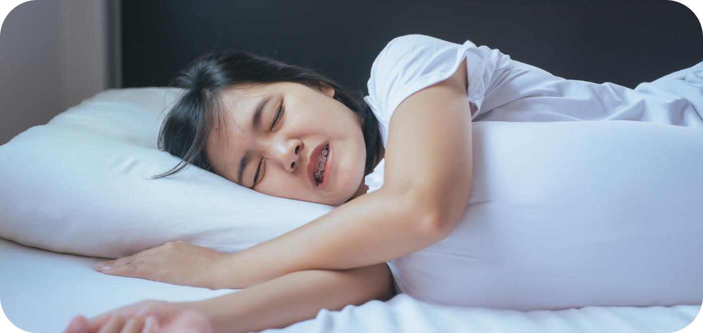 Bruxisme Orthodontiste Marseille 10 | Drs Couchat, Gaillard & Toga