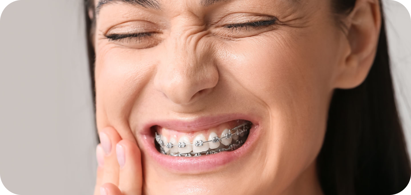 Appareils multi-attaches Orthodontiste Marseille 10 | Drs Couchat, Gaillard & Toga