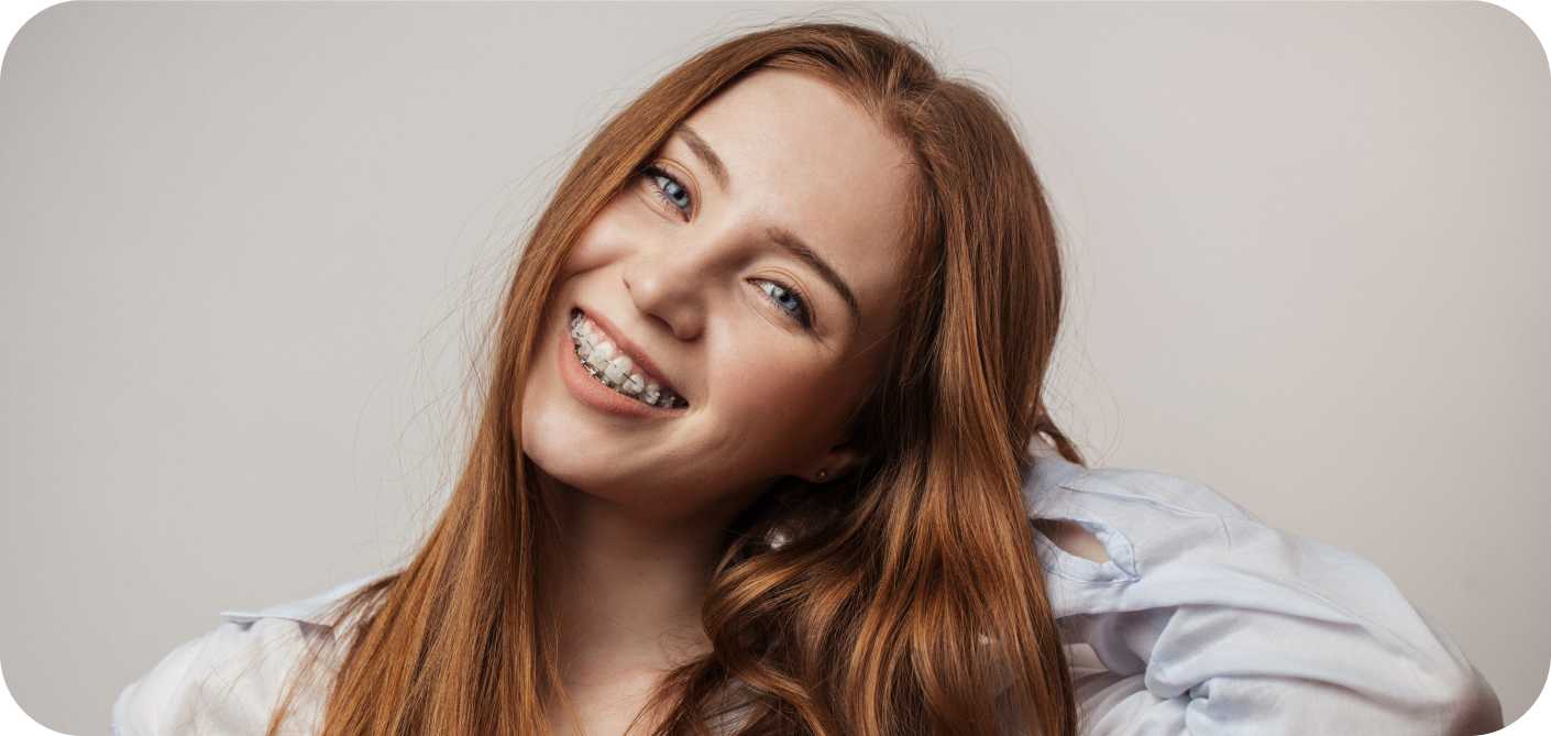 Appareils multi-bagues Orthodontiste Marseille 10 | Drs Couchat, Gaillard & Toga