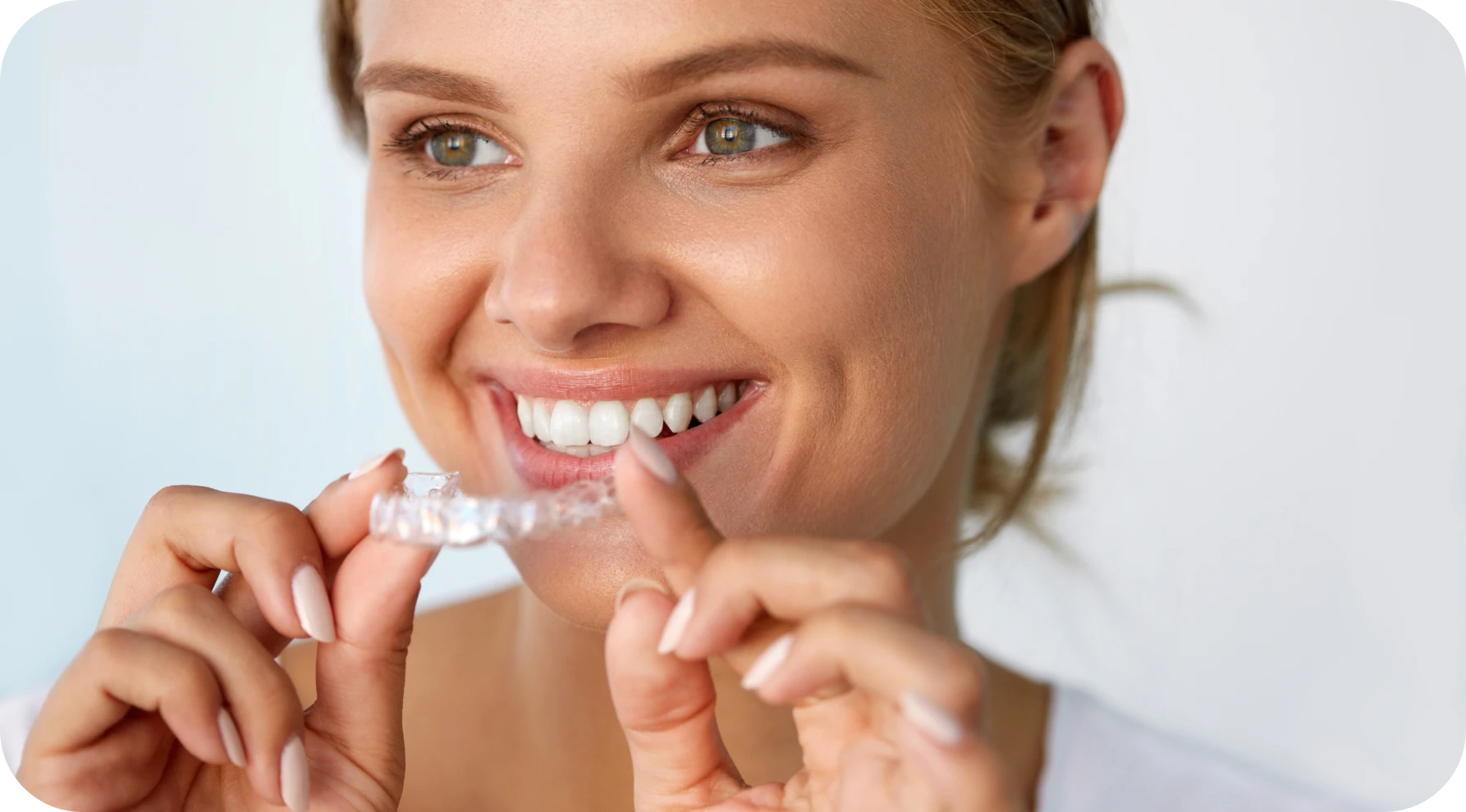 Aligneurs invisibles